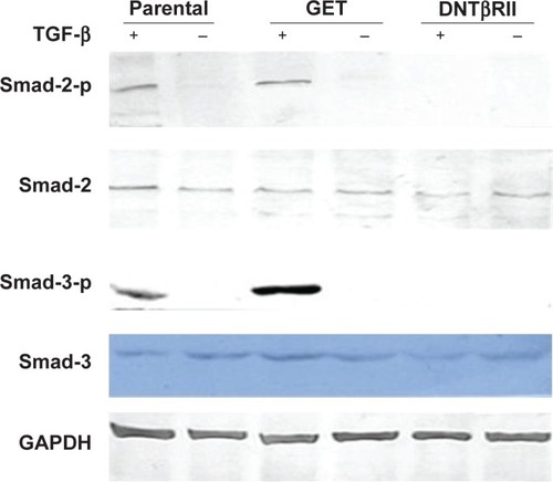 Figure 3 Transfection of pTAR-GET-DNTβRII plasmid prevents phosphorylation of Smad-2 and Smad-3 protein in NK cells. Nucleofection with pTAR-GET-DNTβRII plasmid inhibited Smad-2 and Smad-3 phosphorylation in TGF-β-treated NK cells. TGF-β-mediated phosphorylation of Smad-2 and Smad-3 was observed by Western blotting in parental NK cells and in NK-GET cells but not in NK-DNTβRII cells.