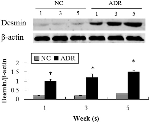 Figure 3. Expression of desmin. Podocyte in the ADR group strongly displayed the podocyte injury marker desmin. The intensities of the protein bands were quantified and normalized to β-actin. A significant difference from the control value is indicated by *p < 0.05.