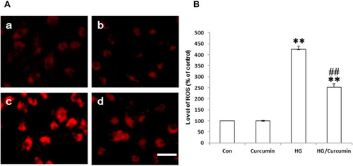 Figure 5 Effect of Curcumin on the ROS production in the HG-treated NRK-52E cells. (A) The HG-induced intracellular ROS levels in NRK-52E cells were measured with DCF-DA staining. a. control group; b. Curcumin group; c. HG group; d. HG/Curcumin group (magnification was ×400, Scale bars=30 μm). (B) Data were expressed as means ± SEM (**P < 0.001 vs Control group, ##P < 0.001 vs HG).