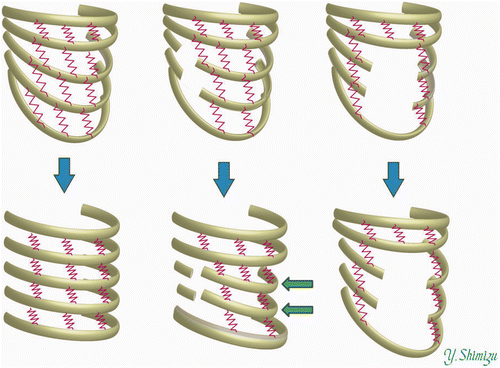Figure 8. Left: Inspiration pattern of normal thorax. With the elevation of the ribs, the volume of the thorax increases. Center: Elevation of the thorax can occur even after the removal of costal cartilages, although some ribs (indicated with arrows) exhibit deviation during inspiration. Right: Elevation of the thorax is impaired when ribs are removed from the lateral parts.