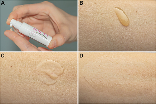 Figure 1 (A) Representative image of ES application onto cutaneous tissue. (B) ES drop after extrusion onto cutaneous surface. (C) ES spreading over the skin. (D) ES integration within the epidermal layer.