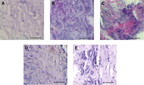 Figure 1 Histological characteristics of normal and osteosarcoma tissues.