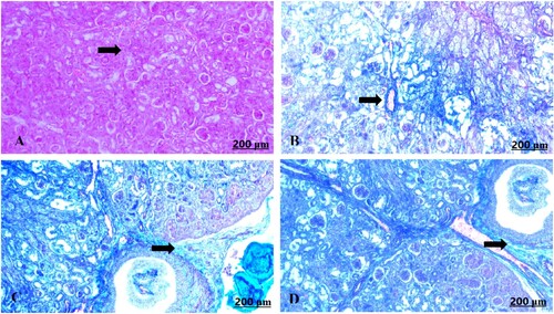 Figure 8. (A–D) Light photomicrograph of sections from foetal kidney of control (A) and GAE received group (B–D) stained with Masson’s Trichrome: light photomicrograph of (A) shows minimally deposited collagen fibres. Photomicrograph of (B–D) shows heavily distributed collagen fibres around the blood vessels.