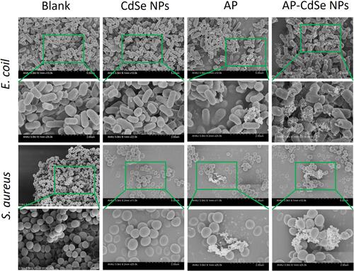 Figure 6 SEM images of MDR E. coli and MDR S. aureus. Bacterial culture treated with AP-CdSe NPs (40 µg/mL). Bacterial culture treated with AP solution (40 µg/mL) and CdSe NPs solution (40 µg/mL) were used as control groups. The PBS-treated group was used as blank group. Green squares indicated the enlarged regions.