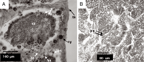 Figure 2 Tubules containing stages of spermatogenesis. (A) s, spermatogonia; ps, primary spermatocytes; ss, secondary spermatocytes; st, spermatids; sz, spermatozoa; ta, tunica albuginea; cy, cysts; (B) ps, primary spermatocytes; ss, secondary spermatocytes; Haematoxylin and eosin stain.