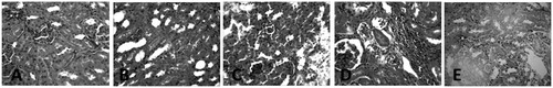 Figure 5. Histopathology of the kidney section of ATZ- and EtoH-treated rats. (A) Control: No visible lesions seen. (B) EtoH: No visible lesion seen. (C) EtoH +50 ATZ: There is a very mild renal cortical congestion. (D) EtoH +100 ATZ: The periglomerular interstitium appears infiltrated. There is a mild congestion of the renal cortex. (E) EtoH +300 ATZ: The renal tubules appear degenerate; many have proteinaceous casts in their lumina. H & E, ×400 Mag.