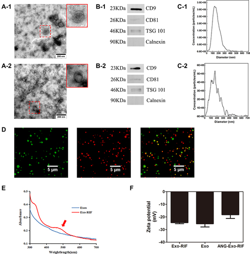 Figure 1 Characterization of the Exo and ANG-Exo-RIF. TEM image of free Exos (A-1) and ANG-Exo-RIF (A-2). Characteristic membrane protein of Exos (B-1) and ANG-Exo-RIF (B-2) analyzed by Western blot. Size distribution of Exos (C-1) and ANG-Exo-RIF (C-2) examined by NTA. (D) ANG-Exo-RIF observed by Exoview. The green fluorescence represents ANG (labeled with FITC), and the red fluorescence represents Exos (labeled with anti-CD81-Alexa 555). Merged fluorescence is shown in yellow indicated colocalization. (E). UV-Vis absorption spectrum of Exo (blue line) and Exo-RIF (red line), Exo-RIF has absorption peak at 473nm (red arrow). (F). The zeta potential of Exo, Exo-RIF and ANG-Exo-RIF.