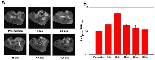 Figure 7 In vivo MR imaging. (A) T1-weighted MR images of tumor at pre-injection and 15, 30, 45, 60 and 120 min after intravenous injection of IO@SiO2-DTPA-Gd NPs, respectively (B) Signal-to-noise ratio changes of T1-weighted images of tumor at different time after administration of IO@SiO2-DTPA-Gd NPs.Abbreviations: Gd, gadolinium; IO, iron oxide, NPs, nanoparticles.