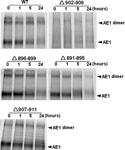 Figure 3.  Pulse chase assay. Transfected cells were pulsed with 50 µCi/ml of [35S]-methionine and cysteine for 20 min. Cells were collected at 0, 1, 5 and 24 h of the chase and AE1 was immunoprecipitated with anti-HA agarose. The amount of radiolabeled AE1 was determined by 8% SDS-PAGE and autoradiography. The arrows indicate the positions of dimer and monomer AE1.