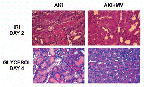 Figure 1 Effects of i.v. injection of MVs from human MSCs in rats with AKI induced by ischemia-reperfusion and in mice with AKI induced by glycerol injection, treated or not with MVs derived from human MSCs. Representative micrographs of renal histology (Haematoxylin and Eosin staining) at day 2 after IRI of rats treated or not with 30 µg of MVs and at day 4 after glycerol injection of mice treated or not with 15 µg of MVs. Original magnification: x400. (described in ref. Citation32).