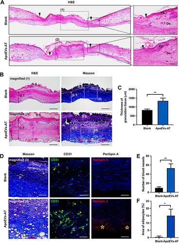 Figure 3 The quality of granulation tissue was improved by ApoEVs-AT. (A) Representative images of wounds on day 8 with H&E staining. The black inverted triangles pointed out the edge of the wound area/the edge of re-epithelization. The black solid boxes represented areas that were magnified. In the right magnified panels, the black dotted lines pointed out the area of the regenerated epidermis. The black dotted boxes represented areas with H&E staining that were magnified in (B). (Ep.: epidermis; De.: dermis. Scale bar = 200 μm.) (B) Representative images of granulation tissue at day 8 with H&E staining and Masson staining. The dotted lines pointed out the edge of the granulation tissue. The solid lines with double arrows represented the thickness of granulation tissue. The white solid boxes represented areas with Masson staining that were magnified in (D). (G.T.: granulation tissue; S.S.: scab shell. Scale bar = 500 μm). (C) The thickness of granulation tissue was analyzed (n=3). (D) Representative images of magnified areas with Masson staining and immunofluorescence staining. The yellow arrows pointed out the blood vessels. The yellow stars pointed out the area of adipocytes. (Green: CD31-stained blood vessels; Red: perilipin A-stained adipocytes, blue: DAPI-stained nuclei. Scale bar = 200 μm). (E) The number of blood vessels per field of view (scale bar=200 μm) was analyzed (n=3). (F) The area of adipocytes was analyzed (n=3). Area of adipocytes (%) was defined as: area of adipocytes/area of granulation tissue×100%. The significance was tested with an unpaired two-tailed Student’s t-test. (*p<0.05, **p<0.01).