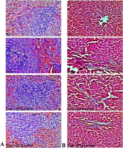 Figure 3 Effect of ICT on histopathological changes in ENU-induced leukemic mice. Representative H&E-stained (A) Spleen and (B) liver tissue section images. Scale bar= 50 µm, Magnification= 400 ×.