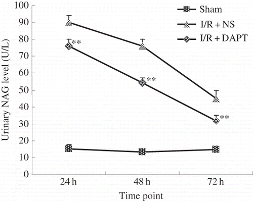Figure 2. The effect of DAPT on the the urinary NAG level. Values are presented as mean ± SEM, *p < 0.05 versus sham at the same time point. **p < 0.05 versus I/R + NS, at the same time point.