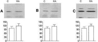 4 Western blot of ubiquitin (A) and phosphoserine (B) after immunoprecipitation with anti-β-catenin in HepG2 cells cultured for 12 days in the absence (C) or presence of retinoic acid (RA). Figure C shows the β-catenin load. Densitometric evaluation of the bands, expressed as percentages of controls, does not show any change. Results are the average of at least four different experiments ±S.D.
