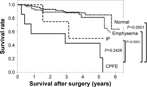 Figure 3 Overall survival in the four groups with pathological stage I disease: Kaplan–Meier curves for overall survival with pathological stage I disease.