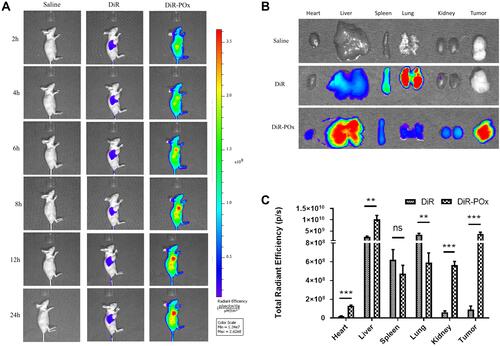 Figure 7 The evaluation of the distribution of DiR loaded micelles in MCF-7 tumor-bearing nude mice after tail vein injection of the formulations. (A) Images taken at 2, 4, 6, 8, 12, 24h after administration of DiR and DiR loaded micelles, respectively. (B) Ex vivo fluorescence images of organs and tumors were collected at 24h post-injection of formulations. (C) Total fluorescence signals of the ex vivo organs and tumors uptake DiR by Imaging Software. Data are expressed as mean ± SD (n=3). ***p<0.001,**p<0.01, nsIndicates p>0.05.