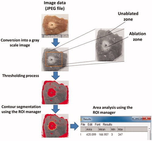 Figure 3. Analysis steps of gross examinations using the software ImageJ to estimate the ablation zone of the tissue sample; the steps comprised greyscale conversion, a thresholding process, and contour segmentations.
