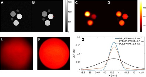 Figure 8 Spatial resolution assessment for MR, PET and co-registered PET-MR images. T1W image (with TE= 11 ms, TR = 350 ms) of the original (A) and averaged (B; N = 20) MR images ([Fe] = 0.70, 1.05 and 1.59 mM), respectively; (C) Reconstructed PET image (A0 = 0.98, 1.48 and 2.22 MBq); (D) Co-registered PET-MR (computed by averaging signals from PET and MR); dashed red, blue and green lines indicate where line profiles were calculated and used to measure FWHM at the edge of phantom images containing the lowest FH [Fe] (i.e. 0.7 mM) and 89Zr activity concentration (0.98 MBq); zoom-in of PET (E) and PET-MR (F) phantom images; (G) measured line spread function (LSF) of the MR, PET and PET-MR images.Abbreviations: FWHM, full width at half maximum; LSF, line spread function.