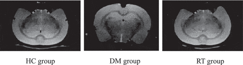 Figure 2. Brain MRI images of rats in each group.