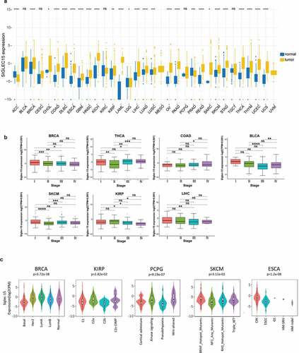 Figure 1. The transcription levels of Siglec-15 in human cancers.