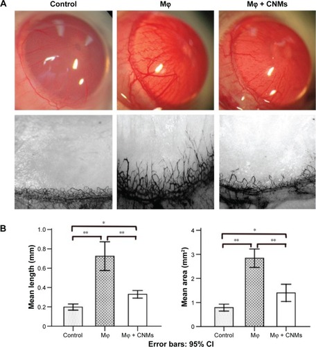 Figure 6 CNMs suppress CNV induced by Mφ in a rat corneal pocket model.Notes: Cells labeled with 1,19-dioctadecyl-3-3-39,39-tetramethylindocarbocyanine were implanted into a surgically created corneal micro-pocket in the right eye of SD rats. On day 5, the CNVs were visualized by ink angiography. (A) Abundant CNVs grew from the limbus toward the pocket in the Mφ group, whereas there was obviously less angiogenesis in the CNMs group. However, angiogenesis was noticeably less in the phosphate-buffered saline group. Magnification ×25. (B) The mean length and area of CNV in the CNMs group were much less than that in the Mφ group. *P<0.05, **P<0.01.Abbreviations: CI, confidence interval; CNMs, celastrol nanomicelles; CNV, corneal neovascularization; Mφ, macrophage; SD, Sprague-Dawley.