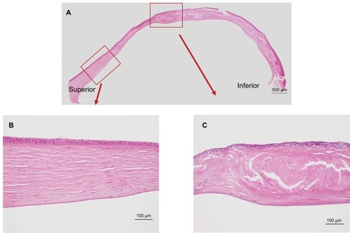 Figure 3 Hemotoxylin and eosin staining of the excised cornea.