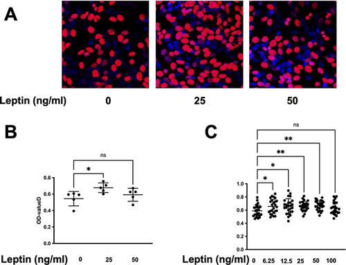 Figure 2 Leptin enhances the viability and proliferation of prostatic stromal cells. (A and B) EdU assay was performed to measure the proliferation of prostatic stromal cells treated with different concentrations of leptin (0, 25, 50 ng/mL) for 24 h. The results showed that leptin significantly increased the proliferation ratio of prostatic stromal cells at 25 ng/mL, but not at other concentrations. Data are presented as mean ± SD of three independent experiments. *P < 0.05, **P < 0.01 compared with control group. (C) CCK-8 assay was performed to measure the viability of prostatic stromal cells (WPMY-1) treated with different concentrations of leptin (0, 6.25, 12.5, 25, 50, and 100 ng/mL) for 24 h. The results showed that leptin significantly increased the viability of prostatic stromal cells in a dose-dependent manner.