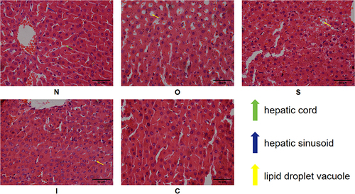 Figure 3 HE staining of liver tissue. N, normal control group; O, obesity control group; S, obesity+swimming exercise group; I, obesity+intermittent fasting group; C, obesity+swimming combined with intermittent fasting group.