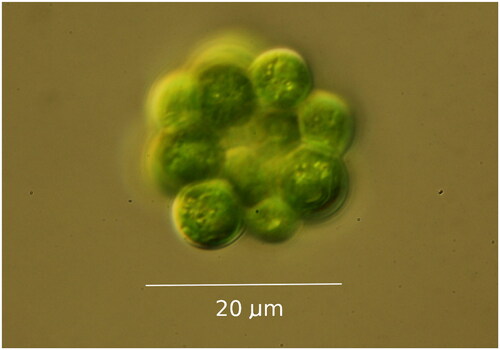 Figure 1. Light Micrograph of Coelastrum microporum, taken by the authors, from the strain deposited as UTEX 3178.