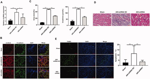 Figure 5. Circ-Snrk Knockdown decreased the left kidney injury severity. (A) qRT-PCR was used to evaluate the relative expression of circ-Snrk expression in the left kidney. Sham group (n = 5), AKI + shRNA NC group (n = 5), and AKI + shRNA group (n = 5). (B) The location of circ-Snrk in the kidney was detected using the FISH experiment, and E-cadherin was used to indicate the location of renal tubular epithelial cells. (C) The levels of serum creatinine (Cr) and blood urea nitrogen (BUN) in the left kidney were measured in the Sham group, AKI + shRNA NC group, and AKI + shRNA group. (D) hematoxylin and eosin staining assay of the left kidney tissues was performed to estimate the kidney injury. Scale bar = 50 μm. (E) TUNEL staining of left kidney tissues to estimate the apoptosis. Green, TUNEL; blue, DAPI; scale bar = 200 μm.