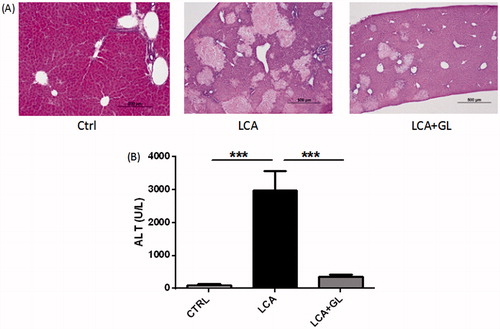 Figure 2. Protection of glycyrrhizin (GL) towards lithocholic acid (LCA)-induced liver toxicity. (A) Histology of liver section from control, LCA-treated, and LCA + GL-treated mice. (B) The activity of ALT in different groups, including control (CTRL), LCA-treated (LCA), and LCA + glycyrrhizin-treated (LCA + GL) groups. Data are given as mean ± S.E.M. (n = 4–5 in each group). ***p < 0.001.