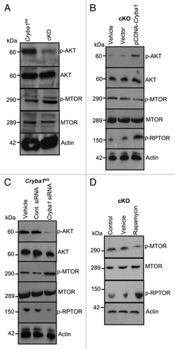 Figure 9.Cryba1 regulates the MTORC1 signaling pathway. (A) Following induction of autophagy in vivo by starvation, RPE/choroid was isolated and levels of signaling intermediates determined. In the cKO samples p-AKT was decreased compared with Cryba1fl/fl, while p-MTOR was increased. Total AKT and total MTOR were not changed. (B) In starved RPE cells cultured from cKO mice, overexpression of CRYBA1 increased p-AKT and p-RPTOR expression, while p-MTOR decreased. (C) Conversely, downregulation of βA3/A1- crystallin expression in Cryba1fl/fl cells using siRNA, decreased p-AKT, and p-RPTOR while p-MTOR was upregulated. (D) Rapamycin, an inhibitor of MTOR, was effective at decreasing p-MTOR and increasing p-RPTOR levels in the cKO cells.