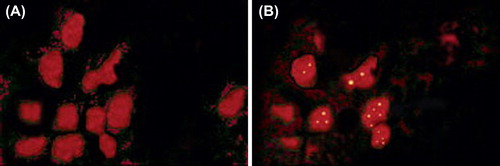 Figure 7. Confocal laser scanning microscopy images showing targeting of the nanoparticles to the M cells of the Peyer's patches in mice by dual staining. M cells were primarily stained with TRITC-WGA (red). FITC-LTA coupled Chitosan nanoparticles stain green. Control nanoparticles (FITC-BSA coated) shows little or no binding to M cells (A). Lectinized chitosan nanoparticles (shown by arrow) were associated predominantly with M cells (B).