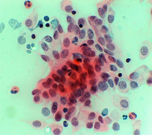 Figure 7 Conjunctival cytology.