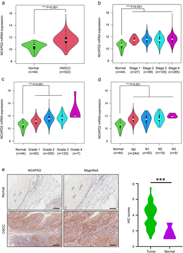 Figure 1. Non-SMC condensin I complex subunit D2 (NCAPD2) was highly expressed in oral squamous cell carcinoma (OSCC). (a) UCSC XENA database analysis of NCAPD2 expression in head and neck squamous cell carcinoma (HNSCC) tissues compared with healthy normal tissues. (b) Expression of NCAPD2 in HNSCC based on clinical stage. (c) Expression of NCAPD2 in HNSCC based on the pathological grade of the tumor. (d) Expression of NCAPD2 in HNSCC based on nodal metastasis status. (e) NCAPD2 expression in healthy and OSCC tissues. Scale bars: left, 200 μm; right, 100 μm. Data are presented as mean ± standard deviation (SD; n = 3), ***p < 0.001.