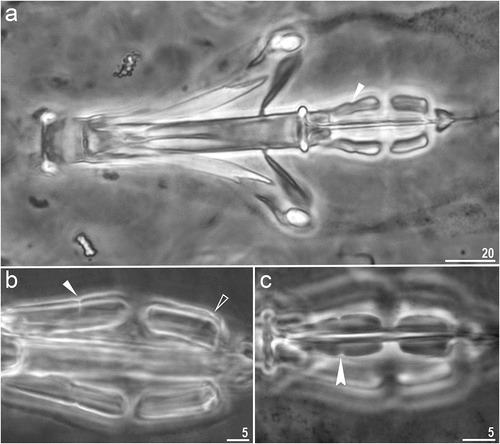Figure 3. Macrobiotus kosmali sp. nov.: bucco-pharyngeal apparatus (dorso–ventral projection): a – general view (paratype); b – placoid morphology in dorsal view (paratype) c – ventral placoids (paratype). Filled unindented arrowhead represents first macroplacoid with central constriction, empty unindented arrowhead represents second macroplacoid with sub-terminal constriction and filled arrowhead indicates a first macroplacoid with central constriction in ventral side. All PCM. Scale bars in µm.