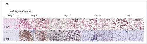 Figure 3. Trauma induces adipose browning up to day 5 following surgery. Representative H&E and UCP1-stained inguinal adipose tissue sections at different time points after surgical trauma as indicated. Data are representative of 4 independent animals per group. Bars represent 20 μm.