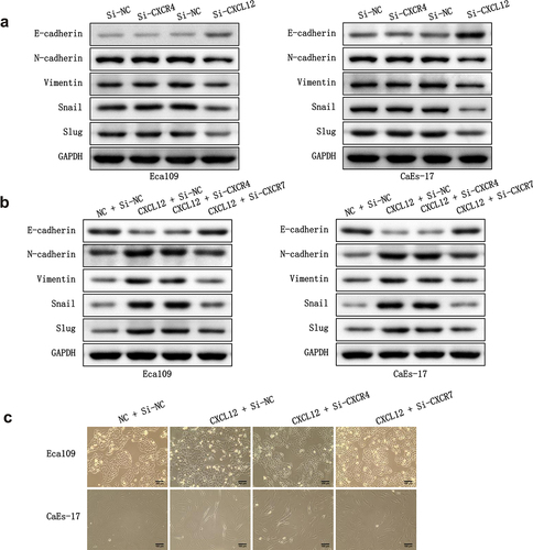 Figure 4. The effect of CXCR4/CXCR7/CXCL12 on EMT process. (a) The effect of silencing CXCR4 or CXCL12 on the expression EMT-related proteins. (b) The effect of overexpressing CXCL12 and knocking down CXCR4 or CXCR7 on the expression EMT-related proteins. (c) The effect of overexpressing CXCL12 and knocking down CXCR4 or CXCR7 on the mesenchymal morphologic changes of Eca-109 and CaEa-17 cells. Scale bar = 100 μm.