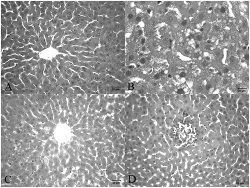 Figure 3. Histopathological changes in (A) alcohol + 50 mg/kg PS-treated rat liver; (B) alcohol + 100 mg/kg PS-treated rat liver; (C and D) alcohol +150 mg/kg PS-treated rat liver.