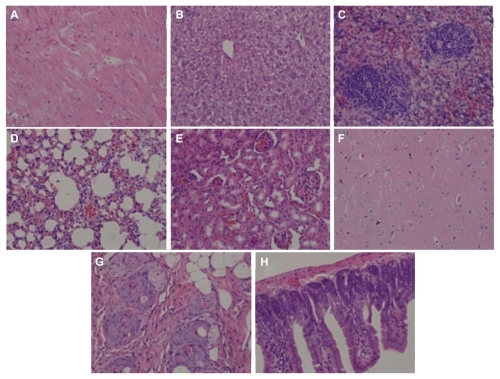 Figure 10 H460 cells were injected into each shoulder of 6–8-week-old female athymic nude (nu/nu) mice. These mice were treated with a single intravenous injection of PGG-PTX (350 mg/mL, paclitaxel equivalent) when tumor size reached an average volume of 100 mm3. Two mice were sacrificed after treatment, and sections of various tissues were examined by using hematoxylin and eosin staining. (A) heart, (B) liver, (C) spleen, (D) lung, (E) kidney, (F) brain, (G) skin, and (H) small intestine.Note: Magnification 100×.Abbreviations: PGG, poly(L-γ-glutamylglutamine); PTX, paclitaxel.