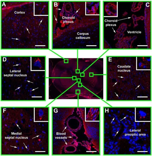 Figure 2 Immunofluorescence confocal microscopy of Hsp70 distribution in the ischemic rat brain.