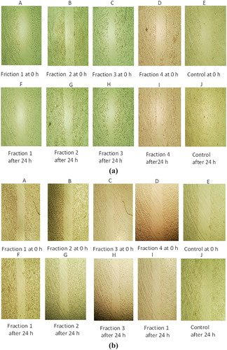 Figure 2. Inhibition of cell migration by cytotoxic fractions of Syzygium aromaticum on (a) H1299 and(b) A549 cell lines.