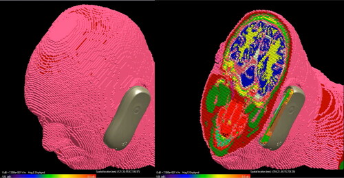 Figure 7. FDTD model of human head impacted by radiation from a cellphone. The image on the left shows the modeled head before the cellphone is turned on and the figure on the right shows the modeled electric field inside the head resulting from the use of the cell phone.Figure 7. Source: https://doi.org/10.1109/5.662875, see endnotes Footnote88,Footnote89. Original simulation image generated using the model described in the source reference.
