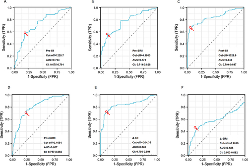 Figure 1 Cut-off, the optimal novel systemic inflammation markers level is used to predict the outcome of cervical cerclage according to the ROC curve. (A) Pre-SII level; (B) Pre-SIRI level; (C) Post-SII level; (D) Post-SIRI level; (E) ΔSII level; (F) ΔSIRI levels.