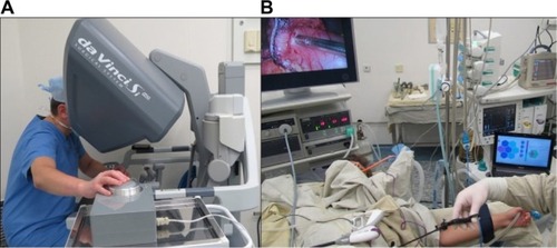 Figure 4 MTEC utilization during a robot-assisted surgery. (A) A surgeon sensing registered tactile data using a tactile display. (B) Intraoperative real-time visualization of registered tactile data.