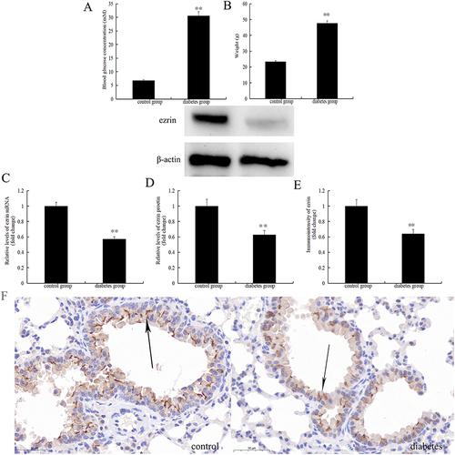 Figure 1 Ezrin expression is decreased in db/db mouse model of diabetes mellitus. (A) Blood glucose concentration and (B) weight of mice in the control and diabetes groups (n=6 each). Ezrin mRNA and ezrin protein expression in the lungs were detected by (C) real-time PCR and (D) Western blot analysis, respectively (n=6). Ezrin protein expression in airway epithelium of diabetic and control mice was examined by (E and F) immunohistochemical staining (n=6) and Representative images (black arrows indicate ezrin expression in airway epithelium). Staining was analyzed by ImageJ software (scale bar = 50 μm, original magnification, ×200) and results are expressed as fold-change diabetic versus control group. **P<0.01.