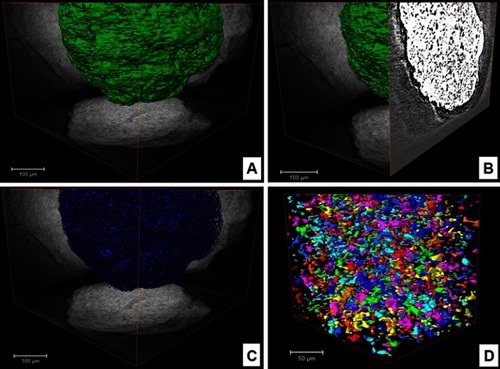 Figure 3 SR-µCT of CHA microsphere: (A) VR of microsphere with normalized orthoprojections; (B) orthoslice showing porous space inside the sphere; (C) VR of porous space inside sphere; (D) box representing individual pores of central microsphere region.Abbreviations: orthoslice, orthogonal slice; SR-µCT, synchrotron radiation-based X ray microtomography; CHA, carbonated hydroxyapatite; VR, volume rendering.