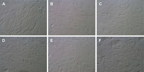 Figure S7 Digital photographs (400× magnification) of NIH 3T3 cells after treatment with PAD-5-1 NPs.Notes: (A) Untreated cells and cells treated with (B) 8.33, (C) 16.7, (D) 25, (E) 33.3, and (F) 41.7 µg·mL−1 of PAD-5-1. PAD-5-1, p(AAPBA-b-DEGMA) (pAAPBA:DEGMA =1:5).Abbreviations: DEGMA, diethylene glycol methyl ether methacrylate; NP, nanoparticle; p(AAPBA), poly(3-acrylamidophenylboronic acid).