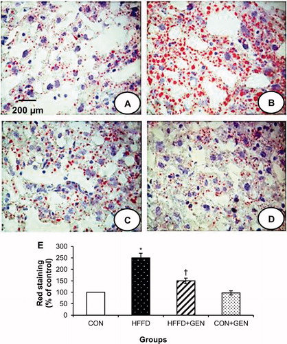 Figure 3. Representative images of the liver sections stained with oil Red O (40×) from each group. HFFD group (B) shows increased red staining suggesting increased fat accumulation. HFFD + GEN group (C) shows decreased red staining as compared to HFFD suggesting a reduction in lipid deposition. CON + GEN group (D) shows staining similar to CON group (A) of liver. Histograms (E) represent mean ± SD (three animals per group). Scale bar 1 cm = 200 µm. *p < 0.05 compared to control; †p < 0.05 compared to HFFD.