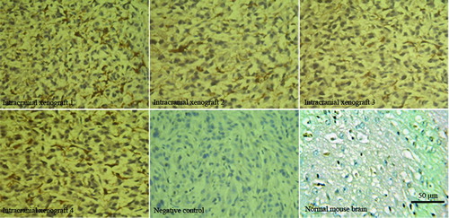 Figure 6  Immunohistochemical analysis of EGFR protein expression in intracranial xenografts. Compared with normal mice brains tissues without EGFR expression, the 4 different intracranial xenografts generated from 4 corresponding flank GBM xenograft lines contain overexpressed EGFR protein. Compared with Figure 2, the intracranial xenografts retain the genetic property of human EGFR overexpression. PBS instead of primary antibodies is used as negative controls.